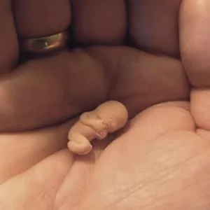 اندازه جنین در هفته هفتم بارداری